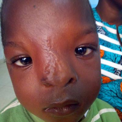 Restore Mission In Ghana 2017 3 20171017 1463787347