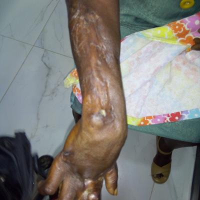 Restore Mission In Ghana 2017 5 20171017 1486937992