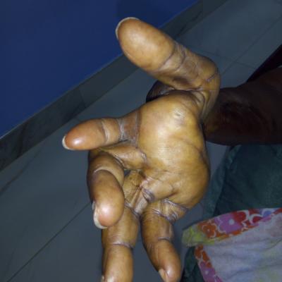 Restore Mission In Ghana 2017 6 20171017 1840345604