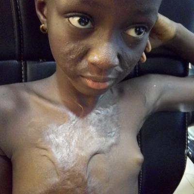 Restore Mission In Ghana 2017 6 20171017 2020465451