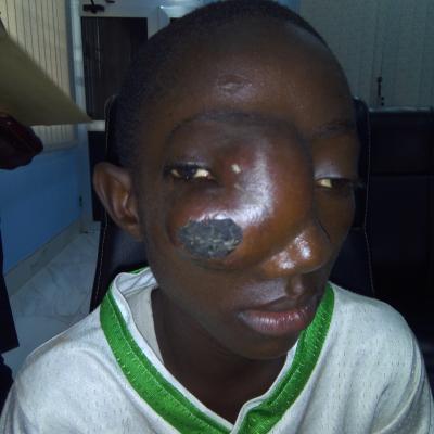 Restore Mission In Ghana 2017 7 20171017 1283123190