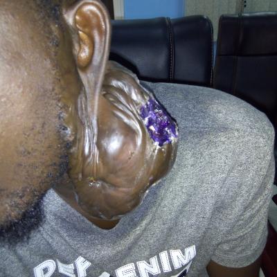 Restore Mission In Ghana 2017 8 20171017 1092614854