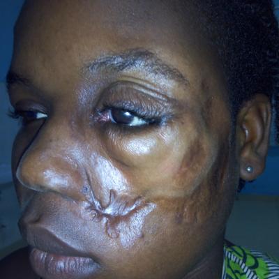 Restore Mission In Ghana 2017 8 20171017 2061419156