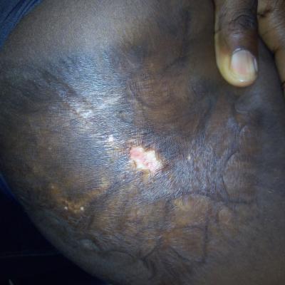 Restore Mission In Ghana 2017 9 20171017 1930075186